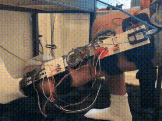 This ACL Rehab Tracker is a great example of real-world biomedical applications.