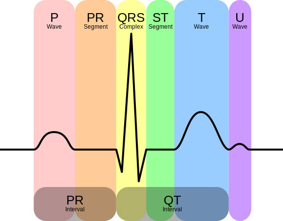 Heart rate monitor - Wikipedia