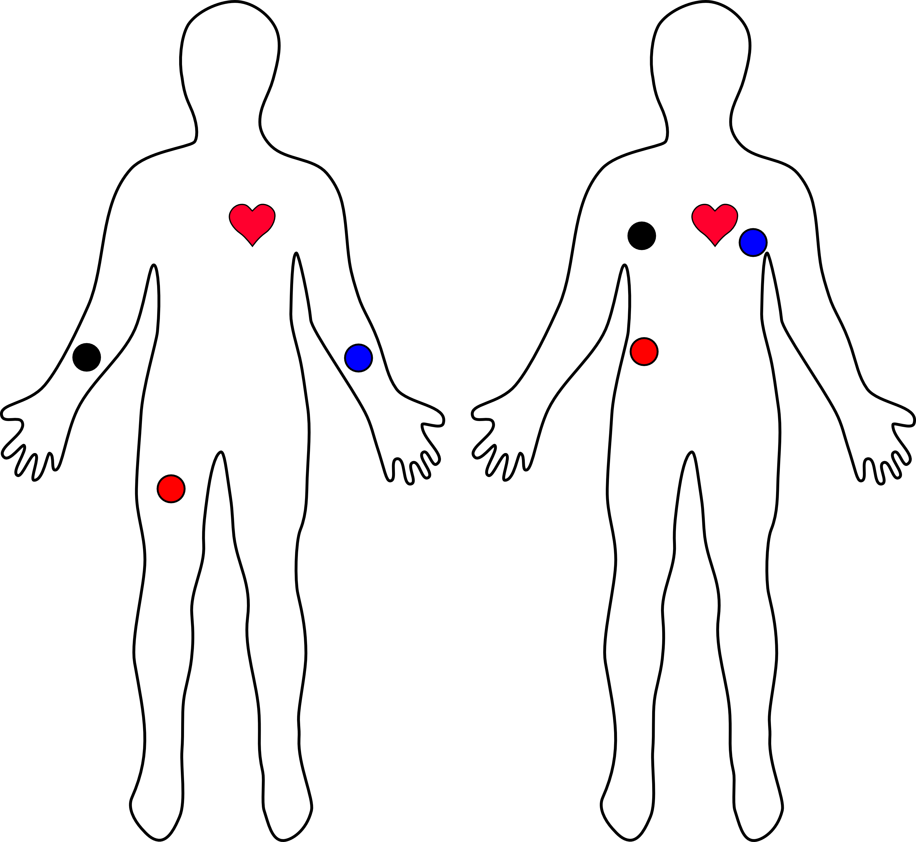 xscope placing guides on the correct monitor