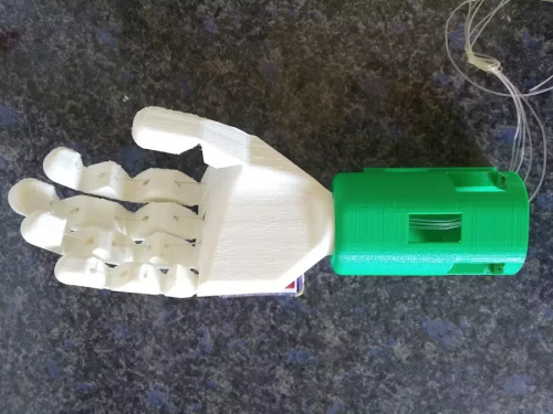 A Myoelectric Sensor-Controlled Hand Prosthesis.
