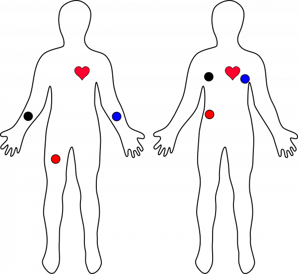 Example Sensor Pad Placement